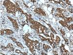 HSP70 Antibody in Immunohistochemistry (Paraffin) (IHC (P))