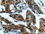 HSP70 Antibody in Immunohistochemistry (Paraffin) (IHC (P))