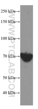 HSP70 Antibody in Western Blot (WB)