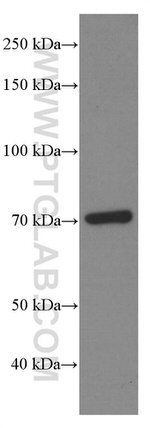 HSP70 Antibody in Western Blot (WB)