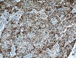 P62/SQSTM1 Antibody in Immunohistochemistry (Paraffin) (IHC (P))