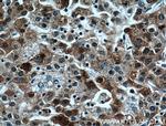 P62/SQSTM1 Antibody in Immunohistochemistry (Paraffin) (IHC (P))