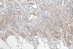 P62/SQSTM1 Antibody in Immunohistochemistry (Paraffin) (IHC (P))