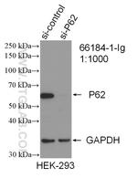 P62/SQSTM1 Antibody in Western Blot (WB)