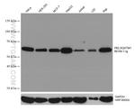 P62/SQSTM1 Antibody in Western Blot (WB)