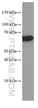 P62/SQSTM1 Antibody in Western Blot (WB)