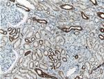 Cytokeratin 18 Antibody in Immunohistochemistry (Paraffin) (IHC (P))