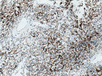 Cytokeratin 18 Antibody in Immunohistochemistry (Paraffin) (IHC (P))