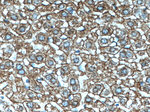 Cytokeratin 18 Antibody in Immunohistochemistry (Paraffin) (IHC (P))