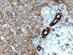 Cytokeratin 18 Antibody in Immunohistochemistry (Paraffin) (IHC (P))