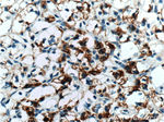 Cytokeratin 18 Antibody in Immunohistochemistry (Paraffin) (IHC (P))