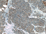 Cytokeratin 18 Antibody in Immunohistochemistry (Paraffin) (IHC (P))