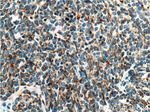 Cytokeratin 18 Antibody in Immunohistochemistry (Paraffin) (IHC (P))