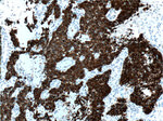 Cytokeratin 18 Antibody in Immunohistochemistry (Paraffin) (IHC (P))