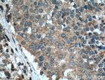 STIM1 Antibody in Immunohistochemistry (Paraffin) (IHC (P))