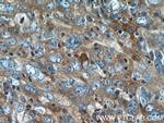 VAPB Antibody in Immunohistochemistry (Paraffin) (IHC (P))