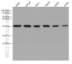 VAPB Antibody in Western Blot (WB)