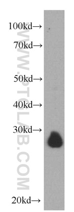 VAPB Antibody in Western Blot (WB)