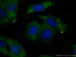 GSNOR/ADH5 Antibody in Immunocytochemistry (ICC/IF)