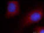 GSNOR/ADH5 Antibody in Immunocytochemistry (ICC/IF)