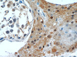 GSNOR/ADH5 Antibody in Immunohistochemistry (Paraffin) (IHC (P))