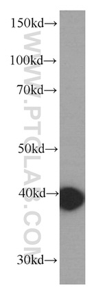 GSNOR/ADH5 Antibody in Western Blot (WB)