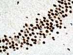 MTA2 Antibody in Immunohistochemistry (Paraffin) (IHC (P))