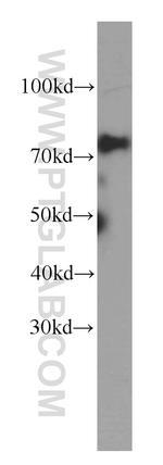 MTA2 Antibody in Western Blot (WB)