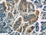 IDH1 Antibody in Immunohistochemistry (Paraffin) (IHC (P))