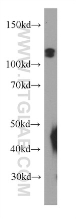 MCM2 Antibody in Western Blot (WB)