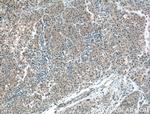 Apolipoprotein AI Antibody in Immunohistochemistry (Paraffin) (IHC (P))