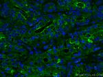 Beta-2-microglobulin Antibody in Immunohistochemistry (PFA fixed) (IHC (PFA))