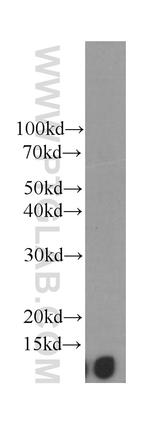 Beta-2-microglobulin Antibody in Western Blot (WB)