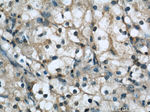 Beta-2-microglobulin Antibody in Immunohistochemistry (Paraffin) (IHC (P))