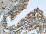 Beta-2-microglobulin Antibody in Immunohistochemistry (Paraffin) (IHC (P))