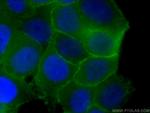 p120 Catenin Antibody in Immunocytochemistry (ICC/IF)