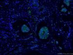 p120 Catenin Antibody in Immunohistochemistry (PFA fixed) (IHC (PFA))