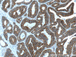 p120 Catenin Antibody in Immunohistochemistry (Paraffin) (IHC (P))