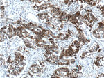 p120 Catenin Antibody in Immunohistochemistry (Paraffin) (IHC (P))