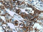 p120 Catenin Antibody in Immunohistochemistry (Paraffin) (IHC (P))