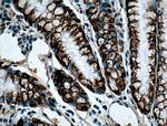 ST6GALNAC6 Antibody in Immunohistochemistry (Paraffin) (IHC (P))