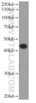 ST6GALNAC6 Antibody in Western Blot (WB)