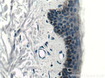 ST6GALNAC6 Antibody in Immunohistochemistry (Paraffin) (IHC (P))