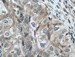 JNK Antibody in Immunohistochemistry (Paraffin) (IHC (P))