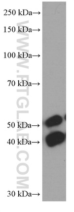 JNK Antibody in Western Blot (WB)