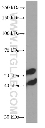 JNK Antibody in Western Blot (WB)