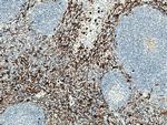 CD13 Antibody in Immunohistochemistry (Paraffin) (IHC (P))