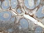 CD13 Antibody in Immunohistochemistry (Paraffin) (IHC (P))