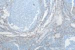 CD13 Antibody in Immunohistochemistry (Paraffin) (IHC (P))