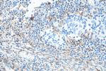 CD13 Antibody in Immunohistochemistry (Paraffin) (IHC (P))